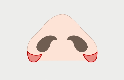外側法