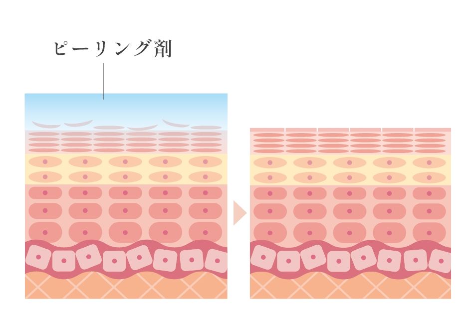 ケミカルピーリングのメカニズム