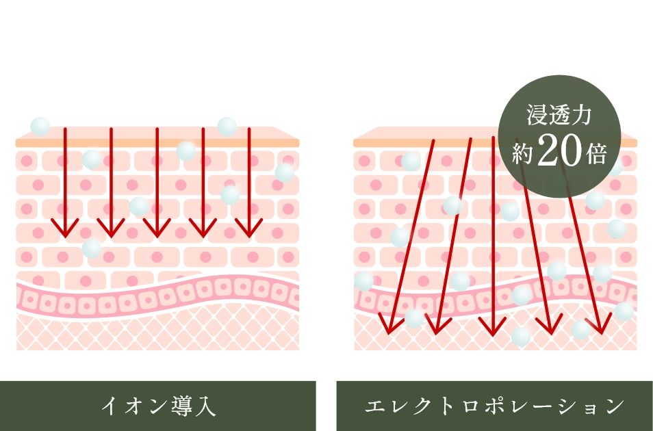 エレクトロポレーションのメカニズム