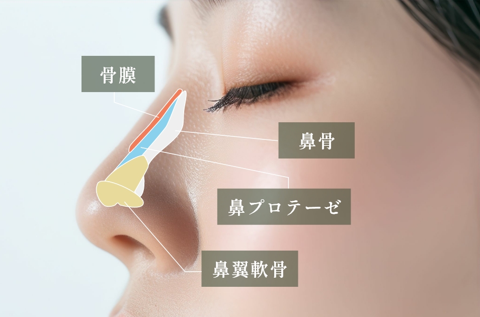 鼻プロテーゼとは