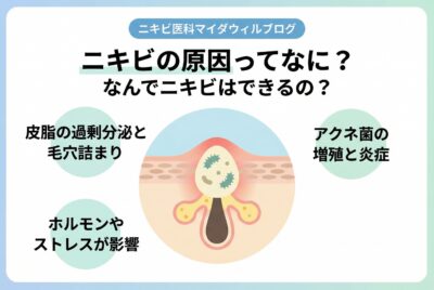 ニキビの原因ってなに？なんでニキビはできるの？