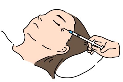 定番のボトックス治療‼どんな効果があるの？