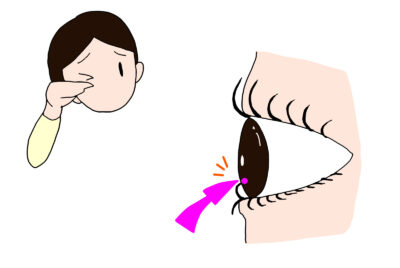 【形成外科専門医監修】下まぶたの逆さまつ毛の治療と保険適用の全知識