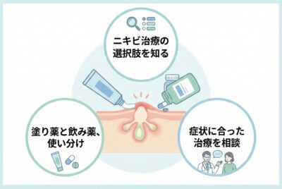 ニキビの治療どんな薬を使用したら良いの？