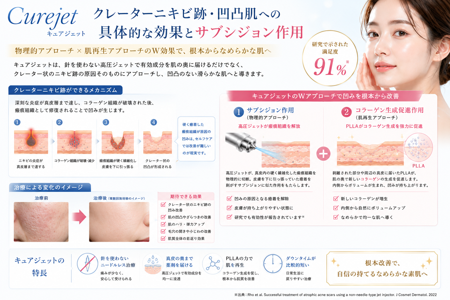 Curejet(キュアジェット)について｜名古屋Re:Birth Clinic 院内ブログ