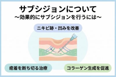 サブシジョンについて〜効果的にサブシジョンを行うには〜
