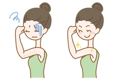 毛孔性苔癬は治る？自宅ケアと薬の効果を皮膚科基準で解説