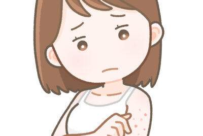 毛孔性苔癬は治る？自宅ケアと薬の効果を皮膚科基準で解説