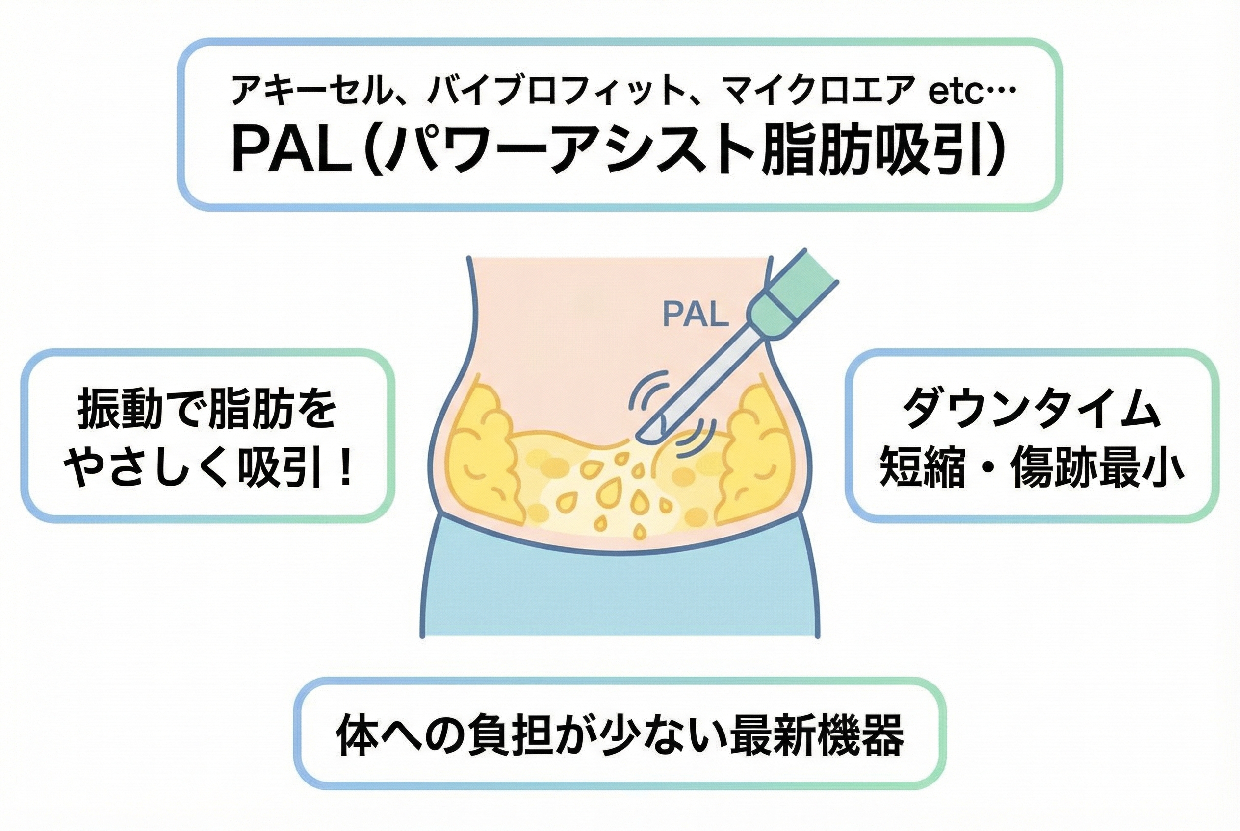 アキーセル、バイブロフィット、マイクロエアetc…PAL(power assisted