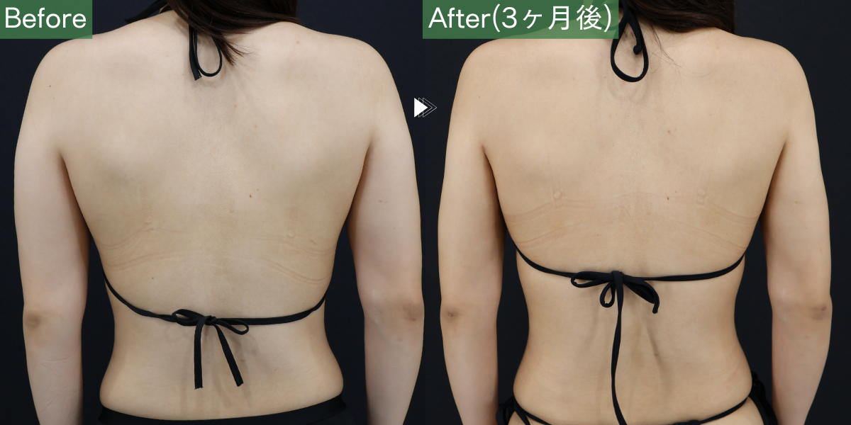 No.5115の症例写真