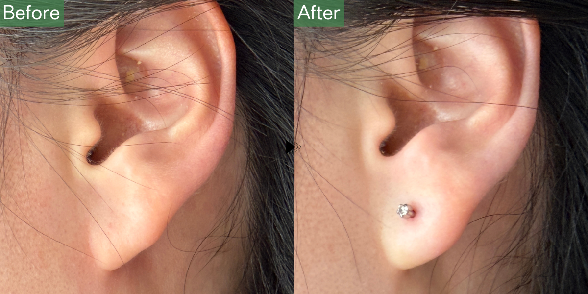 No.5089の症例写真