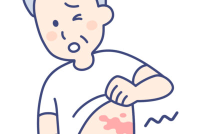 帯状疱疹の前兆を見逃すな：初期症状チェック12項目