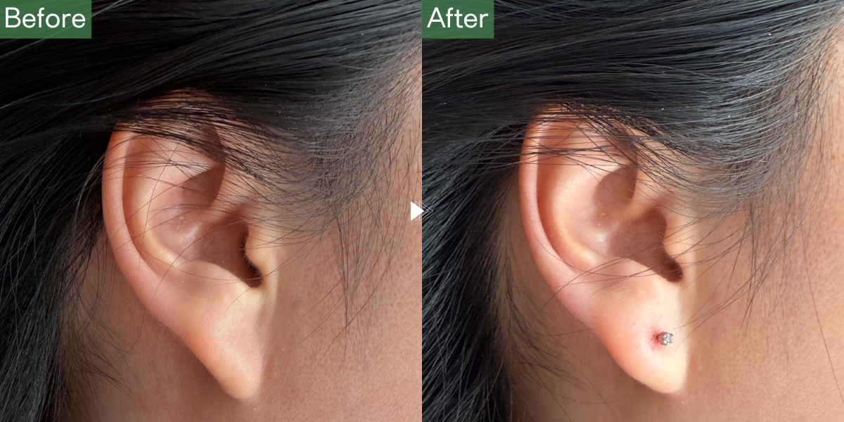 No.5435の症例写真 No.5435の症例写真