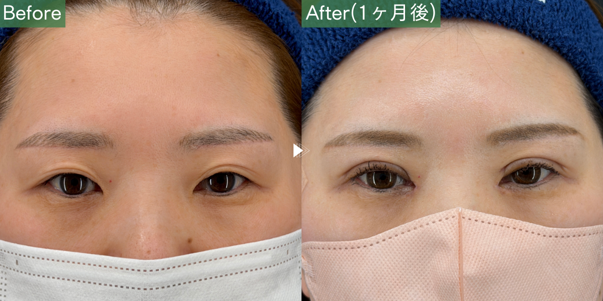 No.5961の症例写真