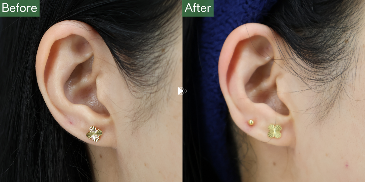 No.6108の症例写真