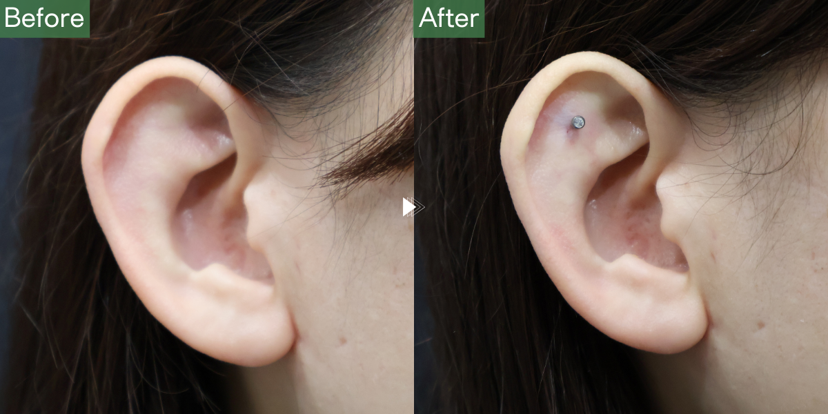 No.6121の症例写真 No.6121の症例写真