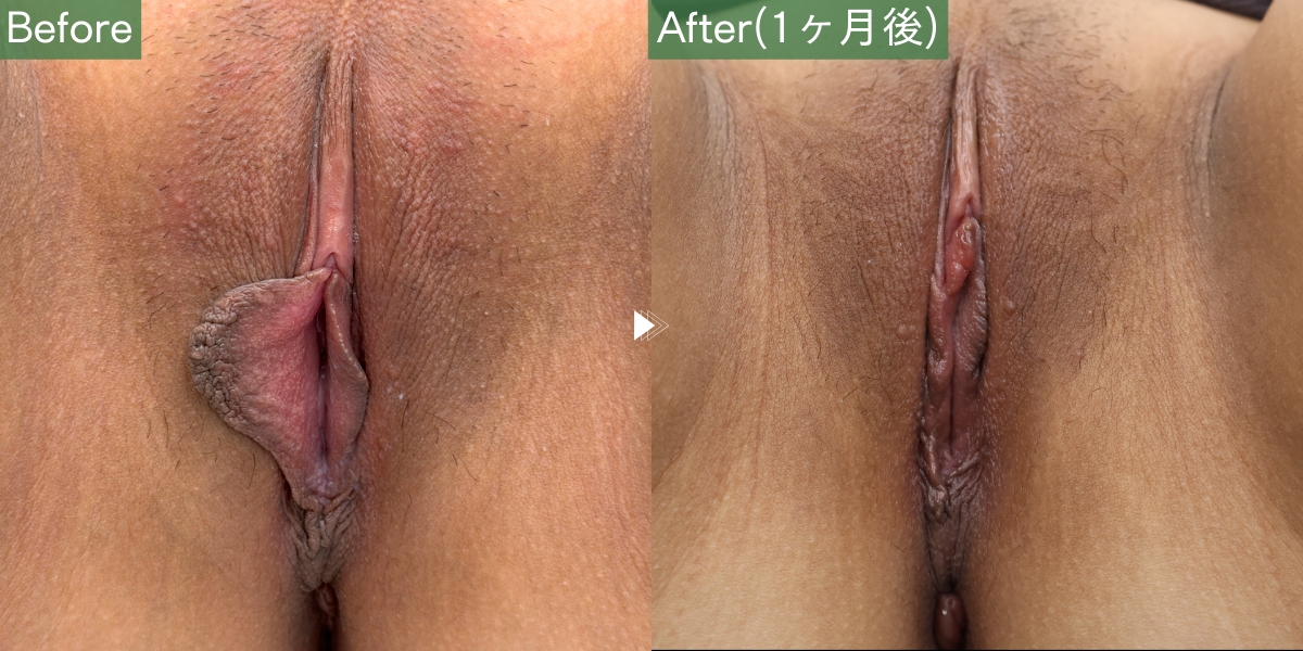 No.5400の症例写真