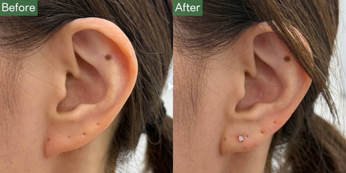 No.6116の症例写真 No.6116の症例写真