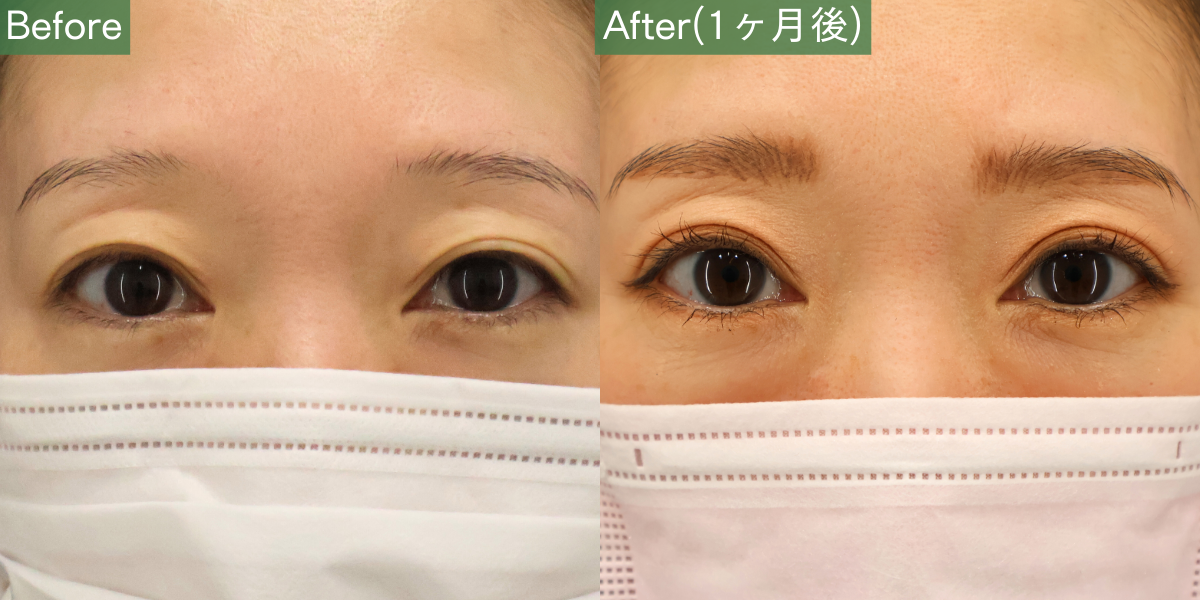 No.5773の症例写真