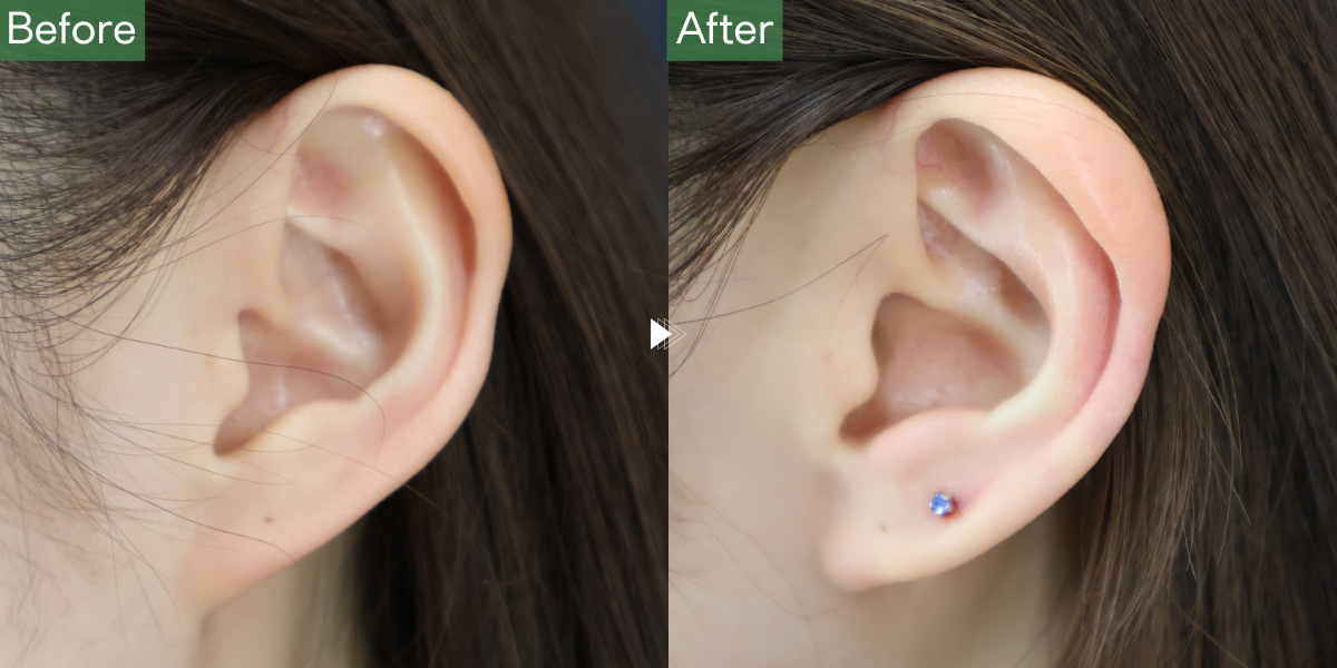 No.6112の症例写真