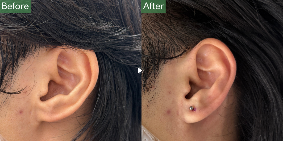 No.5441の症例写真 No.5441の症例写真