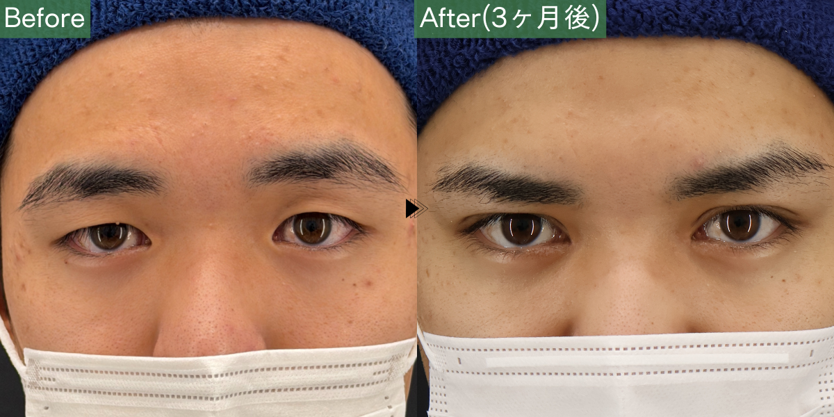 No.5093の症例写真