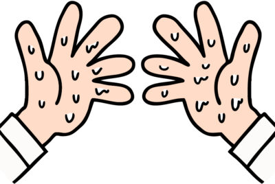 手掌多汗症の原因と最新治療ガイド―ボトックスから外来治療まで