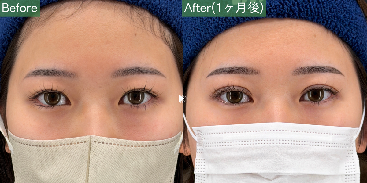 No.5944の症例写真