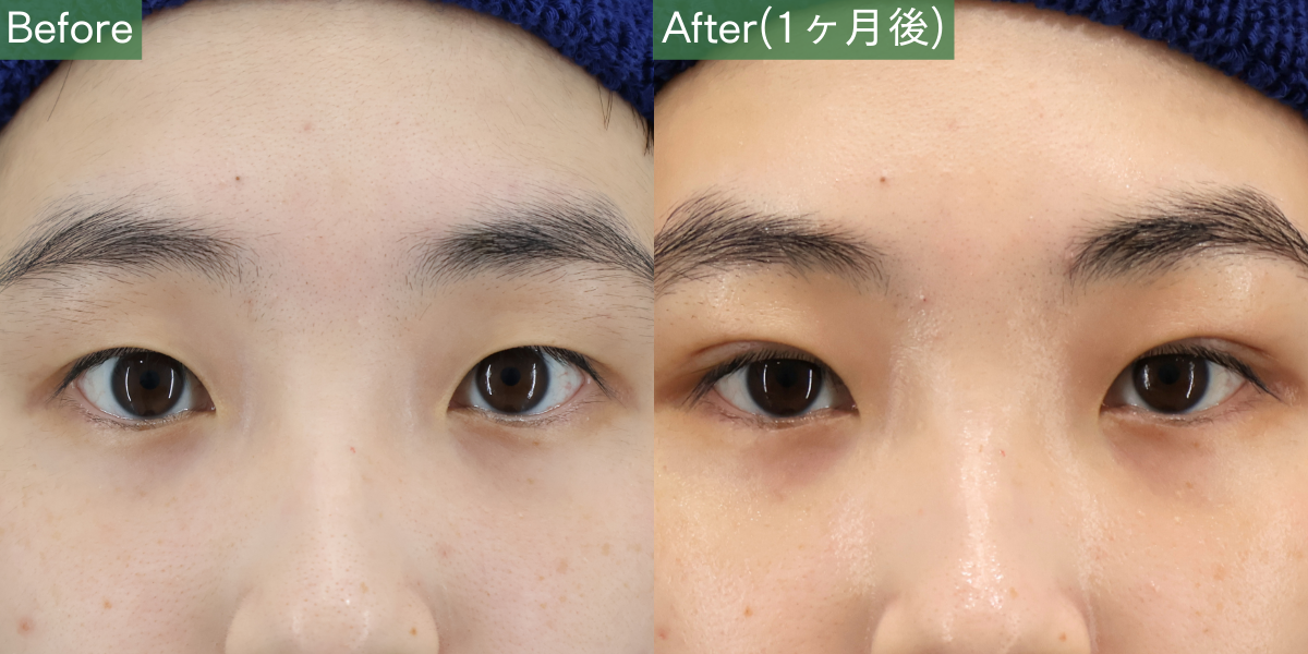 No.5778の症例写真