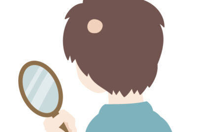 皮膚科医が解説｜円形脱毛症の原因と治療法