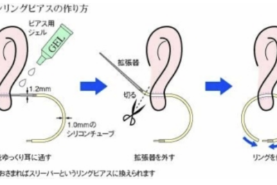 ピアス炎症は穴を塞がず治す！シリコンリング治療ガイド
