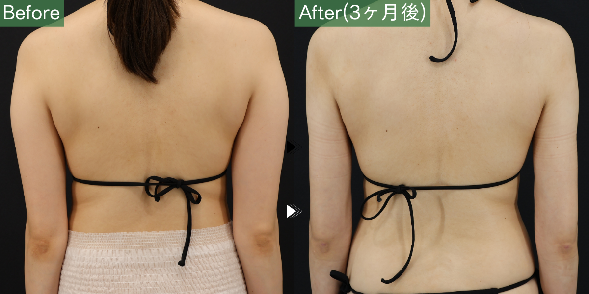 No.5120の症例写真