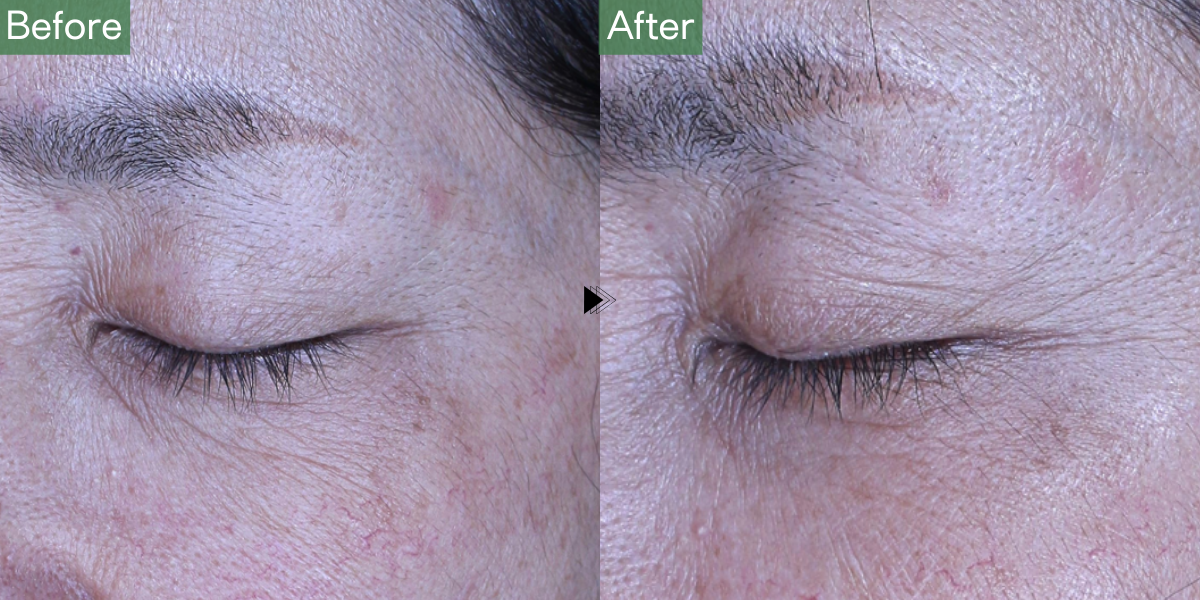 No.5106の症例写真