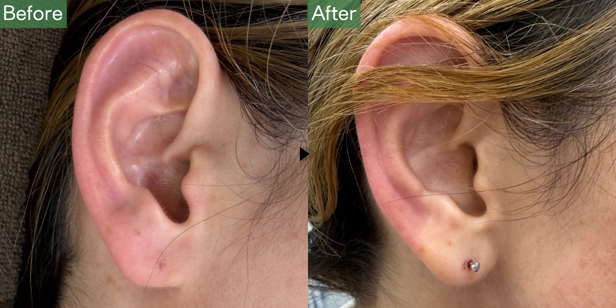 No.5086の症例写真