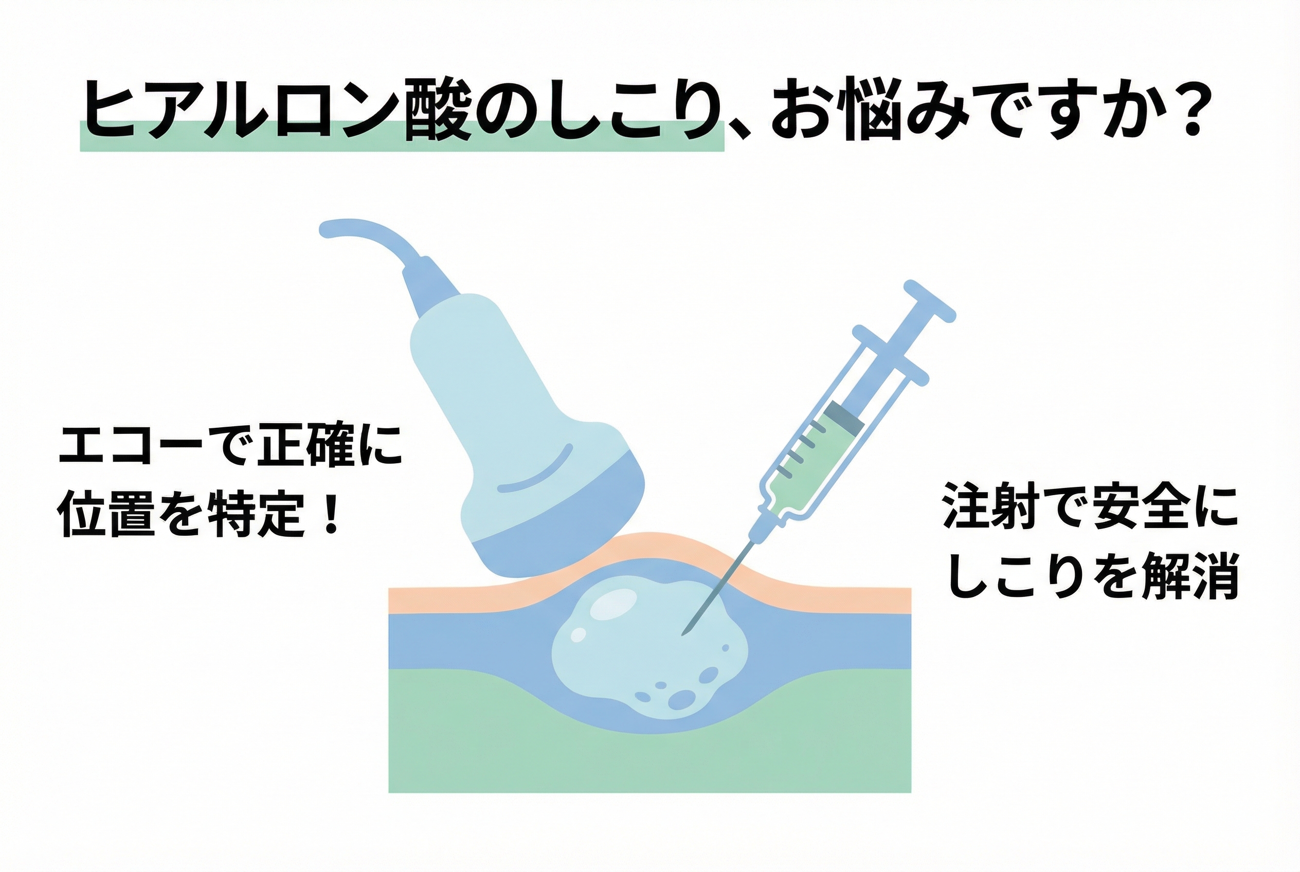 ヒアルロン酸 在庫ラスト まとめ売り 説明用確認！ 木曜日 〜ヒアルロン酸、ボトックス注射〜 | 柳津あおやま眼科クリニック
