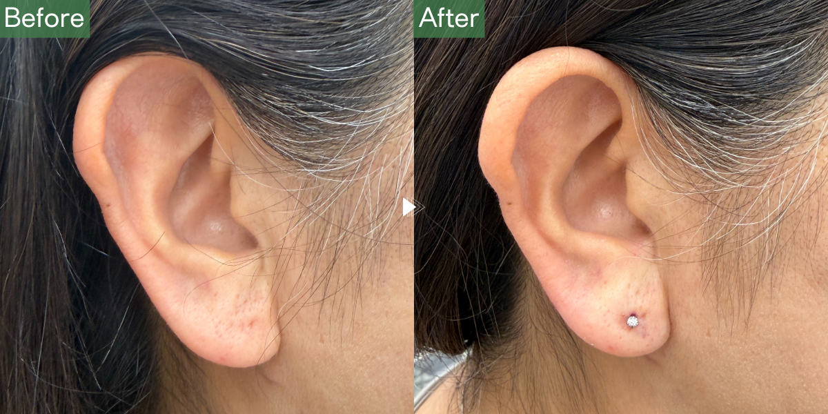 No.5126の症例写真 No.5126の症例写真