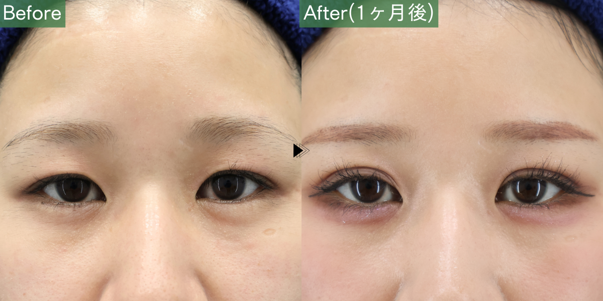 No.5098の症例写真