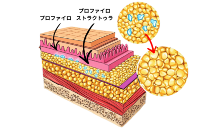 プロファイロ ストラクチュラと従来プロファイロの違い