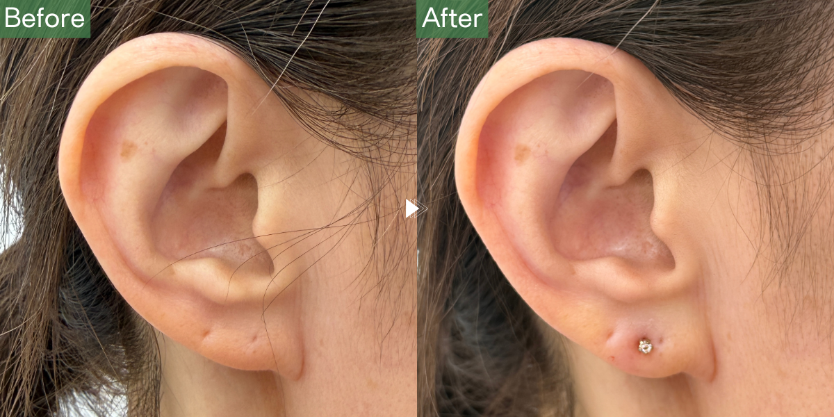 No.5460の症例写真