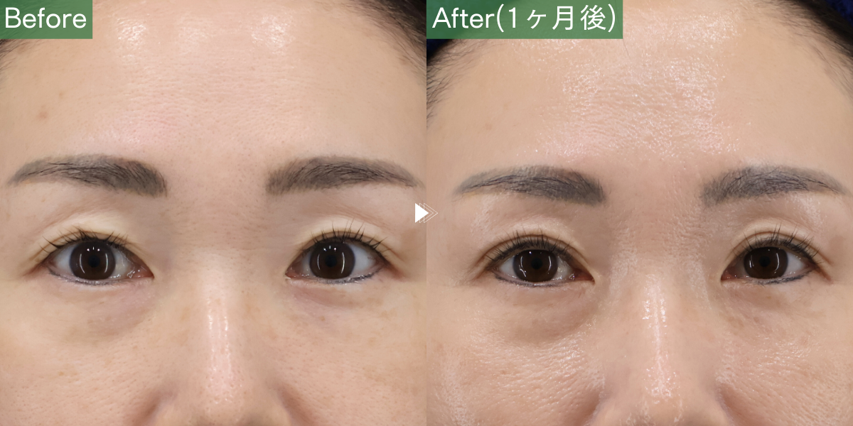 No.5769の症例写真