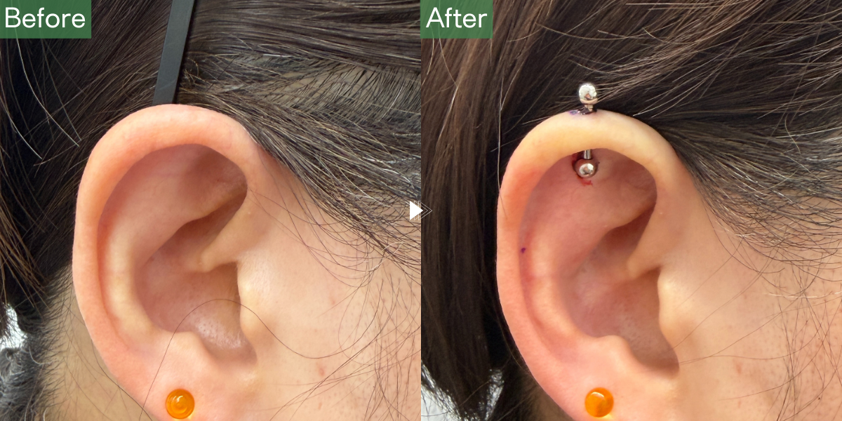 No.5130の症例写真