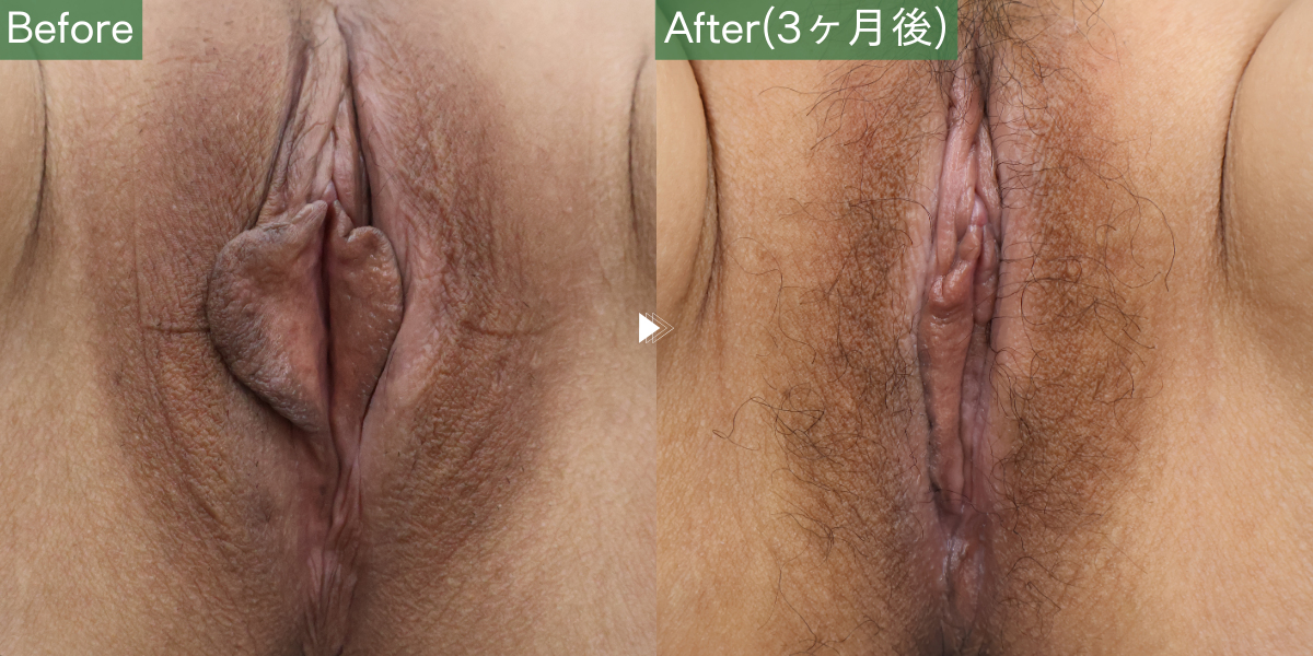 No.5396の症例写真