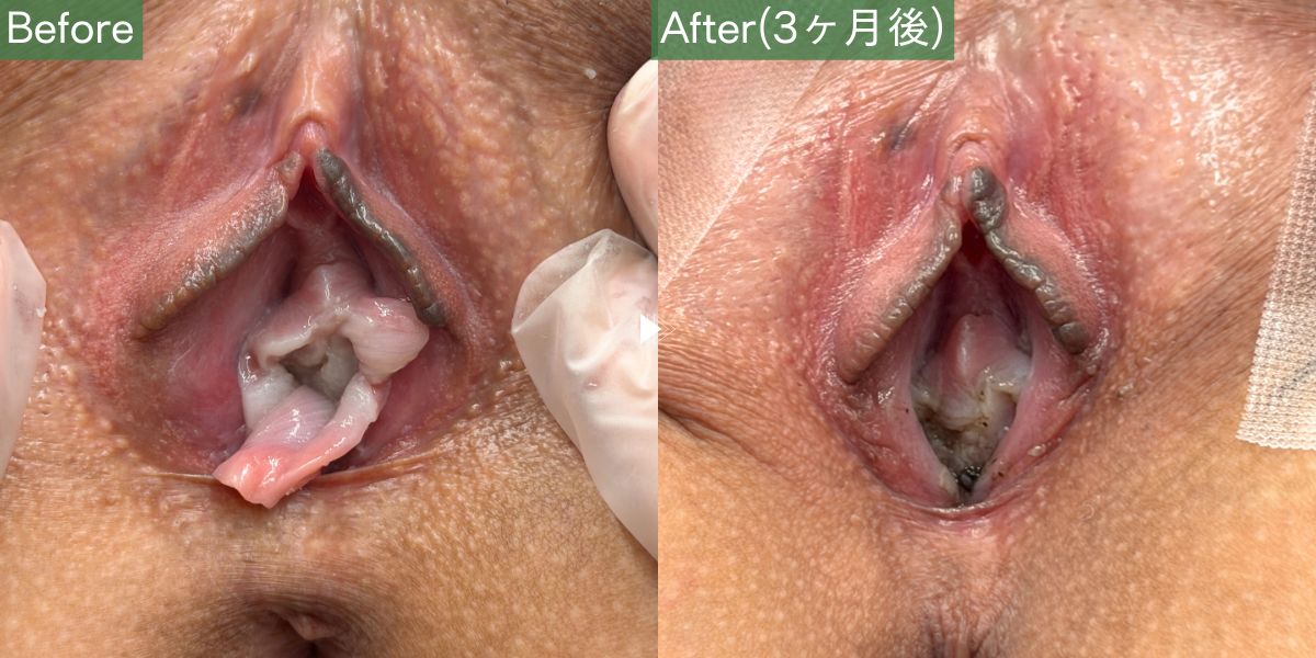 No.5392の症例写真