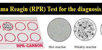 RPR数値の基準と治療判定の目安【梅毒検査の教科書】
