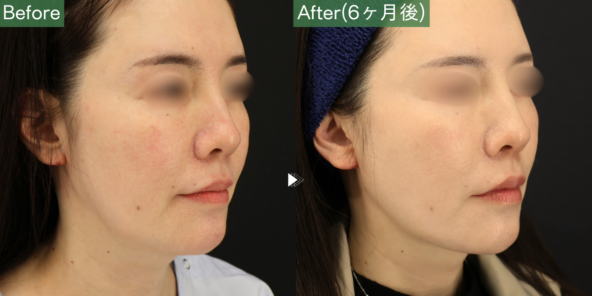 No.6680の症例写真