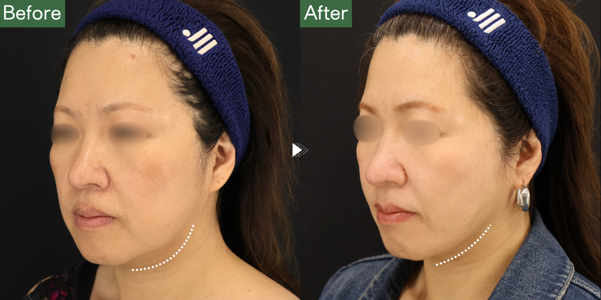 No.6696の症例写真