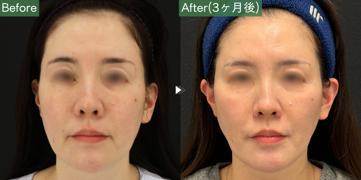 No.6680の症例写真 No.6680の症例写真