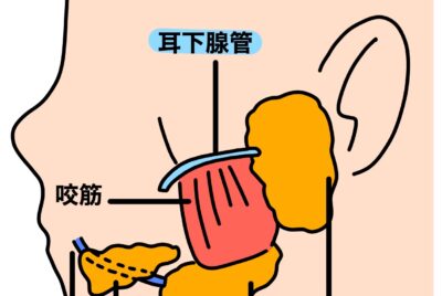 耳下腺ボトックスとえらボトックスの打つ位置解説