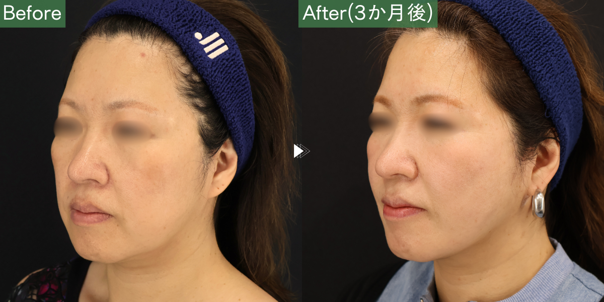 No.6696の症例写真