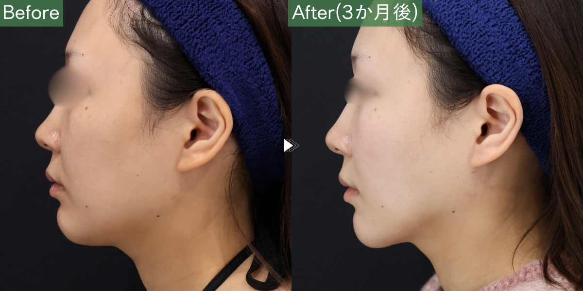 No.6982の症例写真